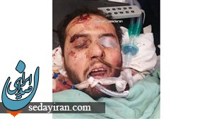 اولین عکس عامل حادثه تروریستی در بیمارستان / حالش وخیم است