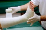 در هر ۳ ثانیه یک‌نفر در دنیا دچار شکستگی استخوان می شود