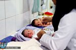 کاهش ۷.۹ درصدی امار سزارین بار اول در کشور کاهش ۷.۹ درصدی امار سزارین بار اول در کشور