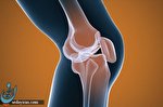 بی اهمیتی بیمه ها به بیماری های روماتیسمی /عوارض مزمن بیماری های روماتولوژی بی اهمیتی بیمه ها به بیماری های روماتیسمی /عوارض مزمن بیماری های روماتولوژی