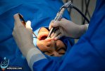 تاثیر عفونت های لثه در فاکتورهای خطر بیماری هایی غیر واگیر تاثیر عفونت های لثه در فاکتورهای خطر بیماری هایی غیر واگیر