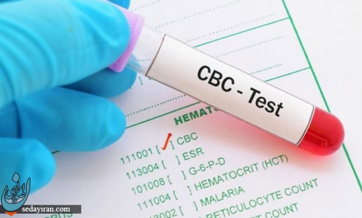آزمایش CBC در آزمایش خون چیست؟ 