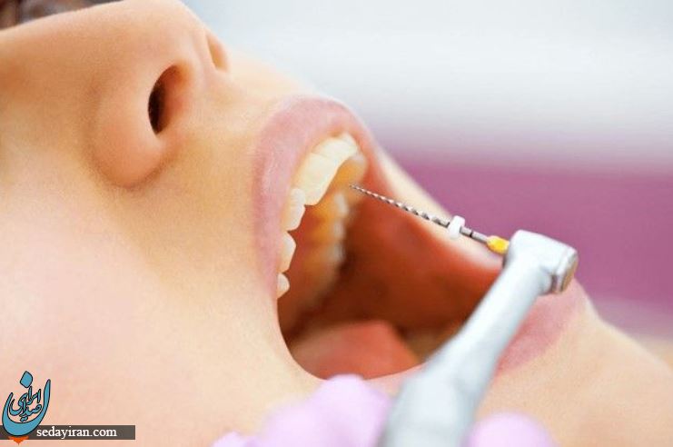درمان ترک خوردن دندان با کامپوزیت، لمینت دندان و روش های دیگر