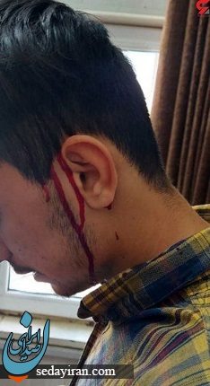 ضرب و شتم دانش آموزان توسط رانندگان در جندی شاپور