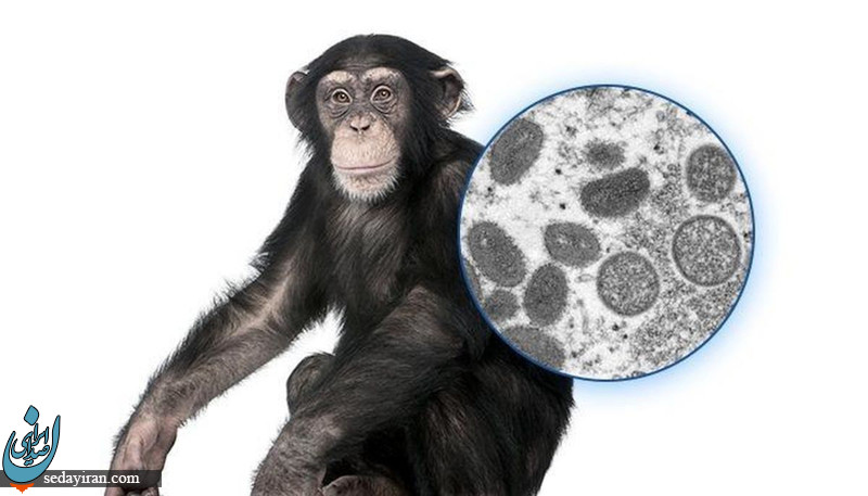 بیماری آبله میمونی چیست؟