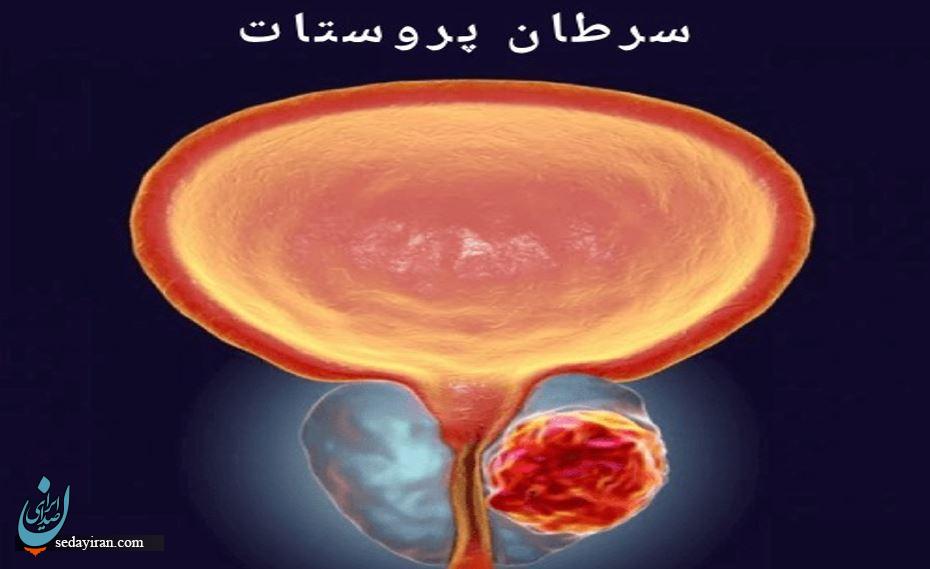 پروستات: غده‌ای کوچک با نقشی بزرگ در سلامت مردان