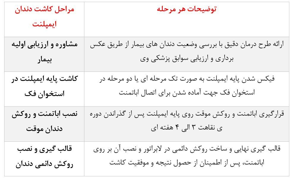 ایمپلنت دندان