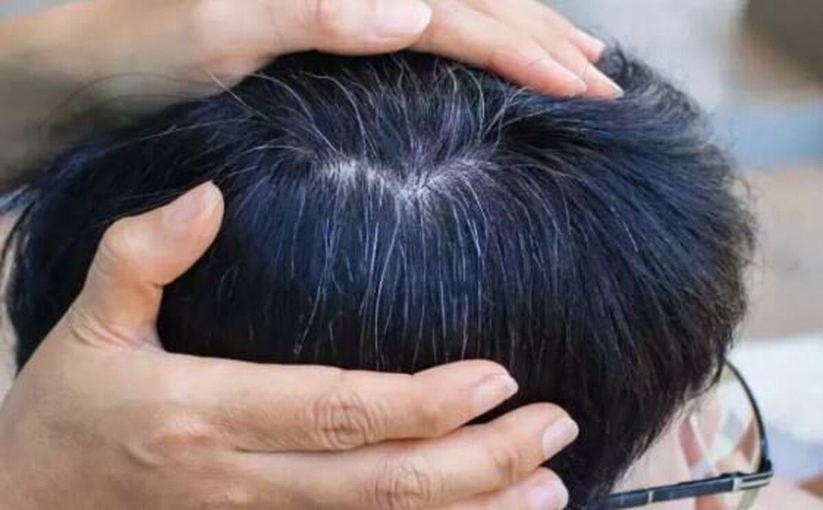 یافتهای جدید درباره سفید شدن مو