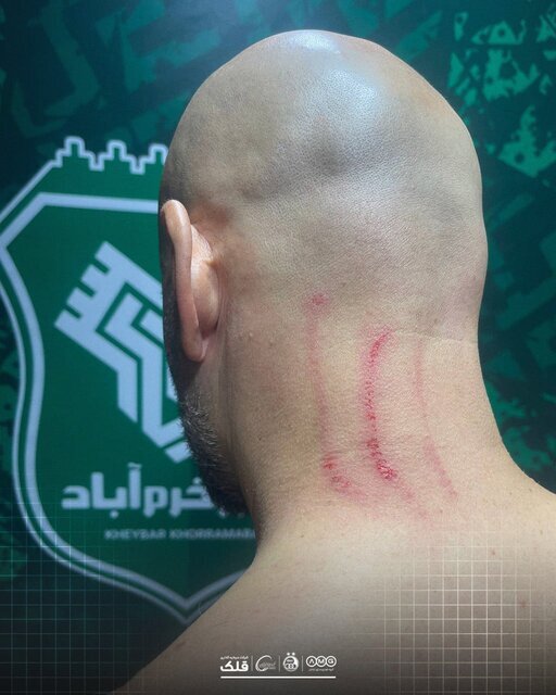 واکنش باشگاههای استقلال و خیبر به اتفاقات بازی امروز واکنش باشگاههای استقلال و خیبر به اتفاقات بازی امروز