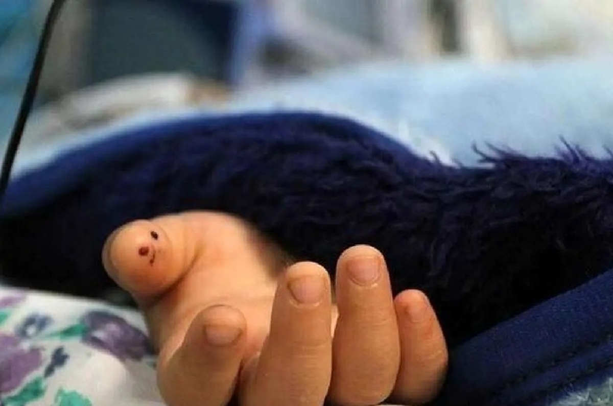 مرگ کودک ۳ ساله همدانی بر اثر روباه‌گزیدگی